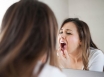 Increase in women with tongue cancer